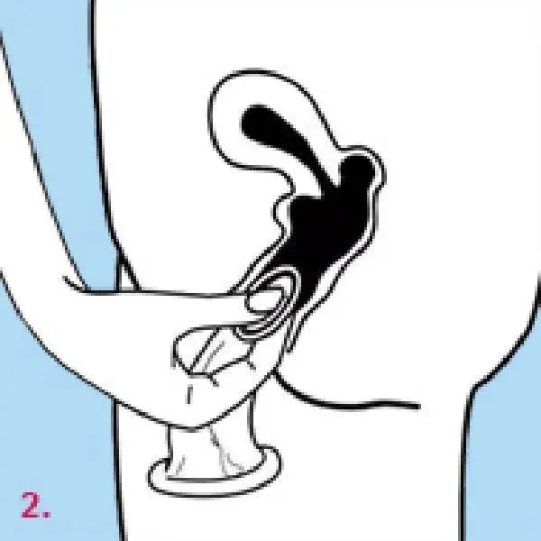 Femidom 3 Pk
