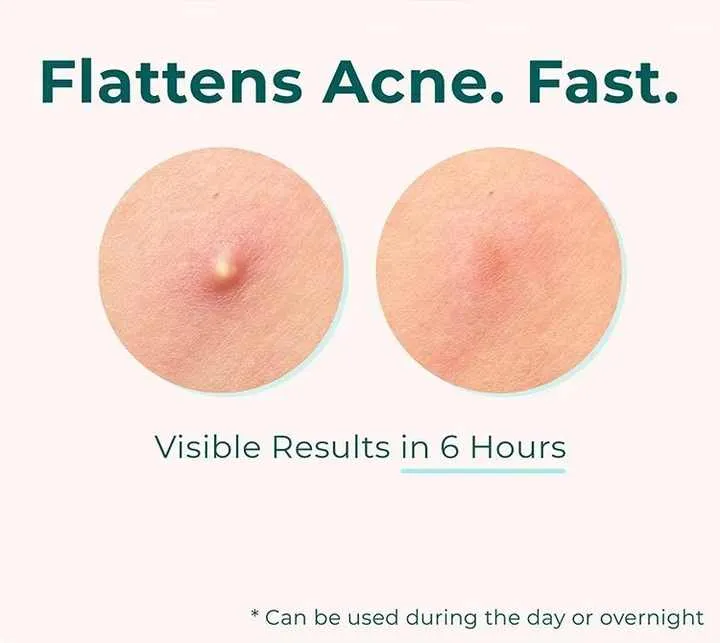 Private Label Box Skin Care Easy -علبة خاصة للعناية